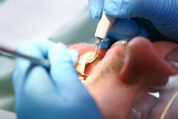 Best Emergency Treatment for Dental Infections or Abscesses in Elkader, IA